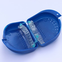 Illustration of an oral appliance