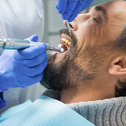 A dentist applying fluoride varnish to a woman’s teeth