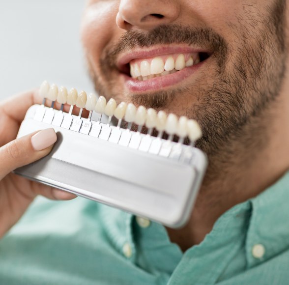 Man's smile compared with porcelain veneer shade chart