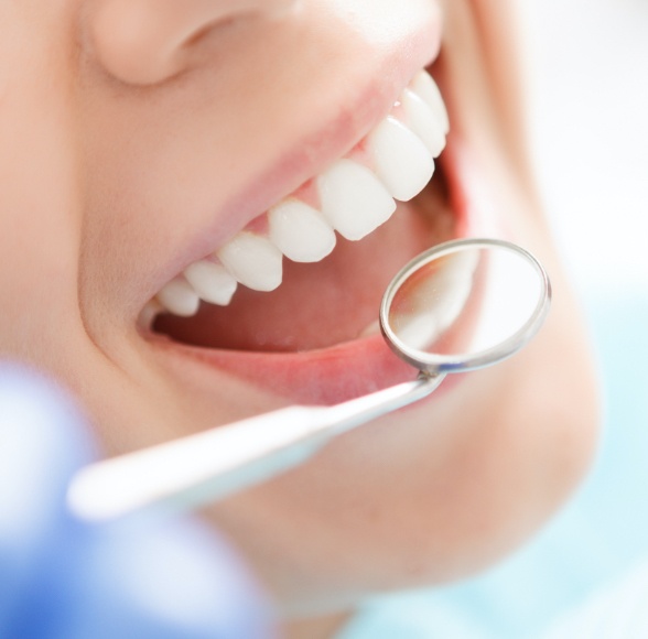 Dentist examining patient's smile after metal free dental restoration