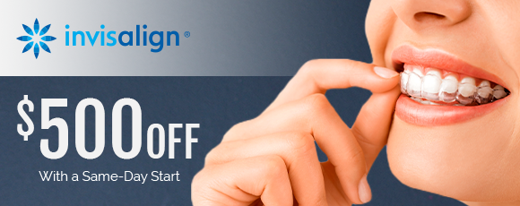 Invisalign special coupon