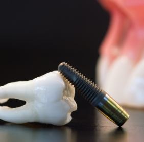 Model tooth and dental implant post