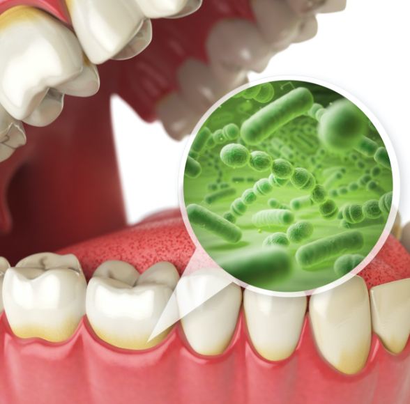 Aniamted smile with enlarged bacteria that cause gum disease