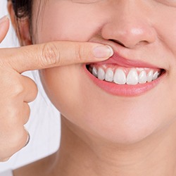 Woman showing off her gums