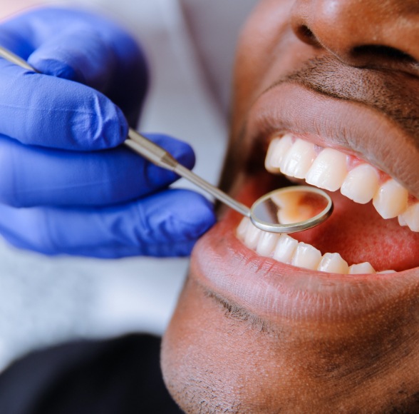 Dentist performing oral cancer screening