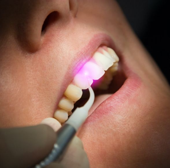 Patient receiving soft tissue laser dentistry treatment