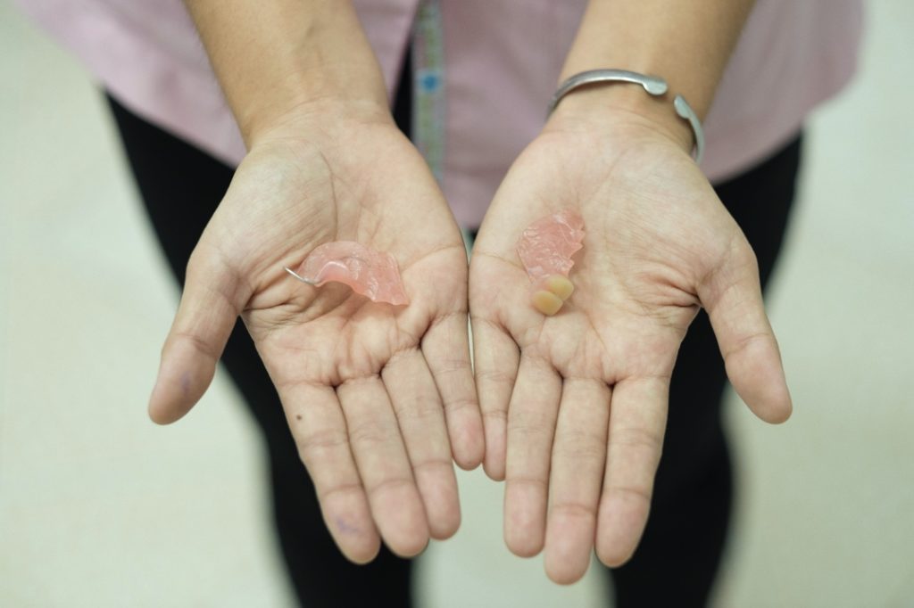 Woman holding damaged dentures