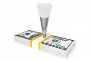 dental implant on top of stack of cash 