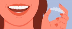 woman invisalign illustration 