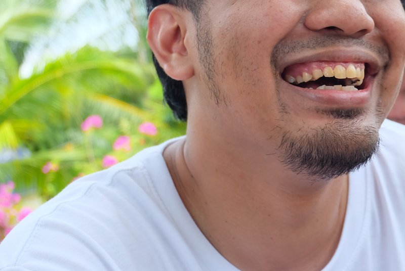 up-close view of person’s stained teeth